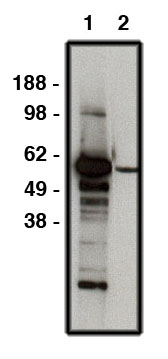 "
Western blot using FBXW7 antibody (Cat. No. X2336P) on human brain lysate (15 µg/lane).  Antibody used at 10 µg/ml (1) and 1 µg/ml (2).  Secondary antibody, mouse anti-rabbit HRP (Cat. No. X1207M) used at 1:50k dilution."